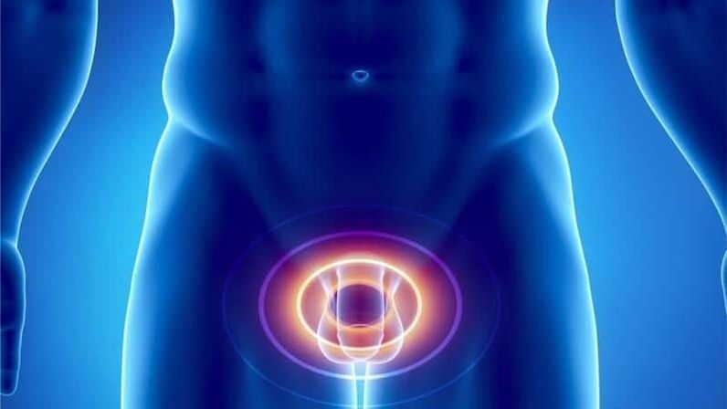 Pain for prostatitis